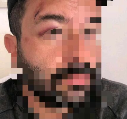 Drogan, golpean y roban a joven turista en bar de zona romántica