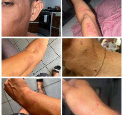 Rechaza Fiscalía denuncia de joven golpeado y robado por policías; la presenta en Asuntos Internos