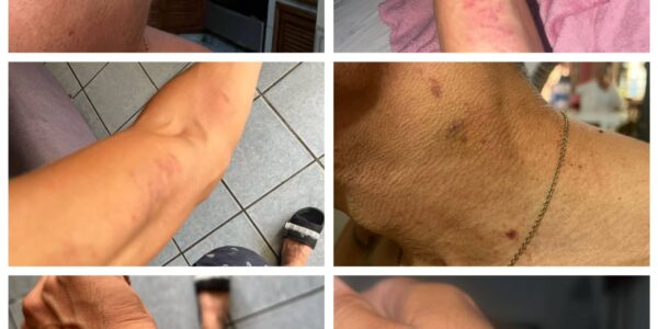 Rechaza Fiscalía denuncia de joven golpeado y robado por policías; la presenta en Asuntos Internos